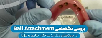 S29- اوردنچر (پارت دو)-دکتر احسان حافظی 1