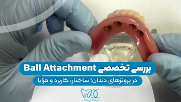 S29- اوردنچر (پارت دو)-دکتر احسان حافظی 1
