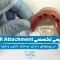S29- اوردنچر (پارت دو)-دکتر احسان حافظی 1