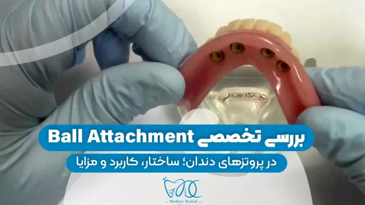 S29- اوردنچر (پارت دو)-دکتر احسان حافظی 1