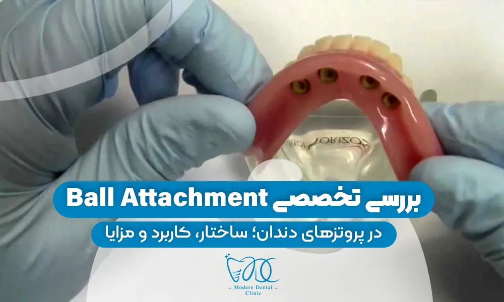 تصویر پیش بار گذاری