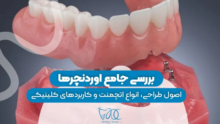 S29- اوردنچر (پارت یک)-دکتر احسان حافظی 1