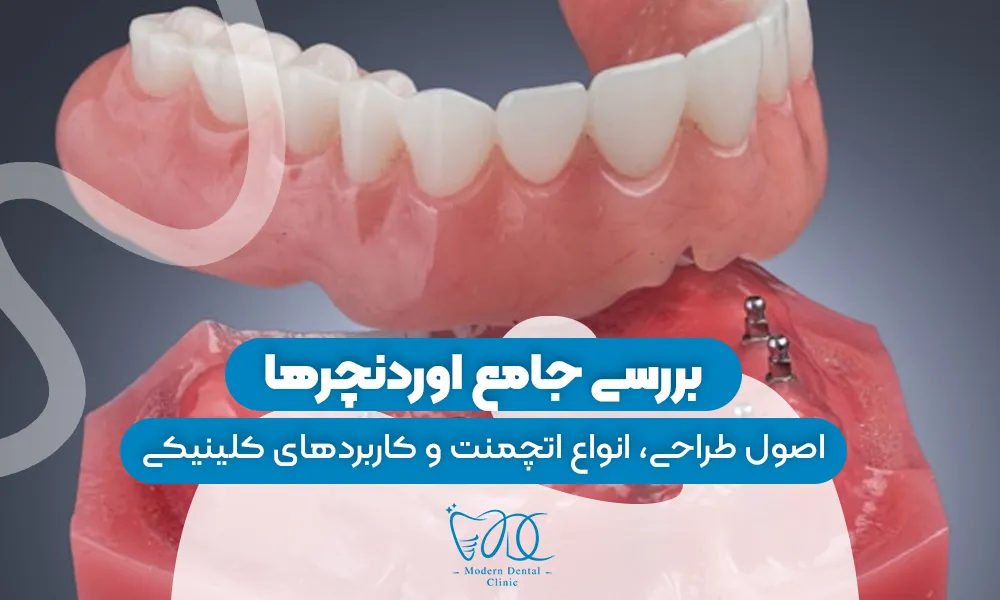 تصویر پیش بار گذاری