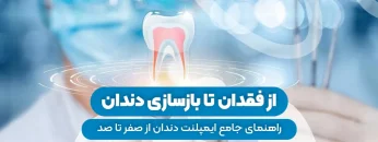 S7- ایمپنت از ابتدا تا انتها- دکتر حافظی 1