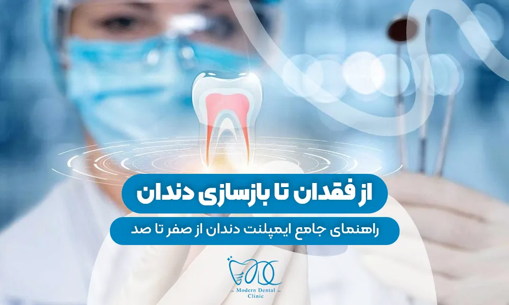 تصویر پیش بار گذاری