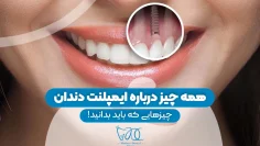 S76-طراحی روکش ایمپلنت- دکتر شیرین اسماعیلی 1