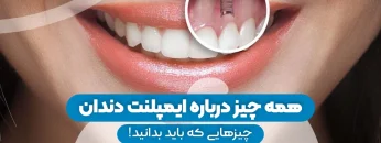 S76-طراحی روکش ایمپلنت- دکتر شیرین اسماعیلی 1