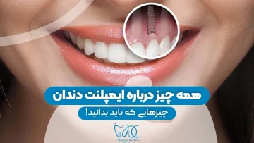 S76-طراحی روکش ایمپلنت- دکتر شیرین اسماعیلی 1