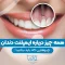 S76-طراحی روکش ایمپلنت- دکتر شیرین اسماعیلی 1