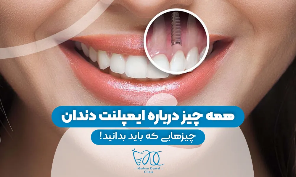 تصویر پیش بار گذاری