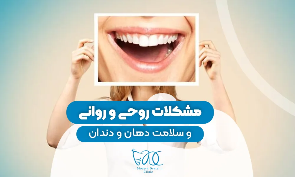 تصویر پیش بار گذاری
