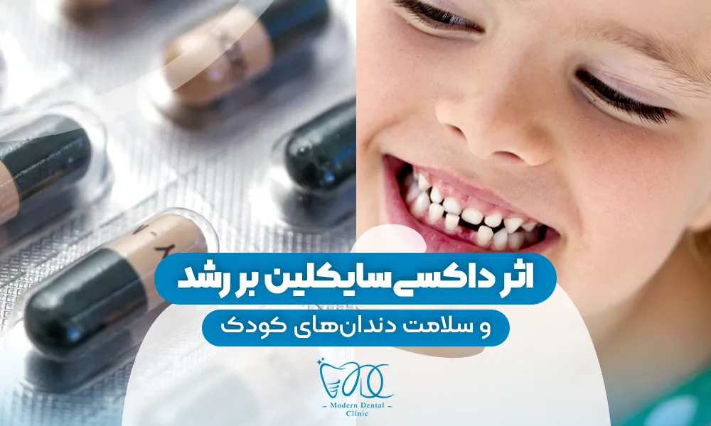 تصویر پیش بار گذاری