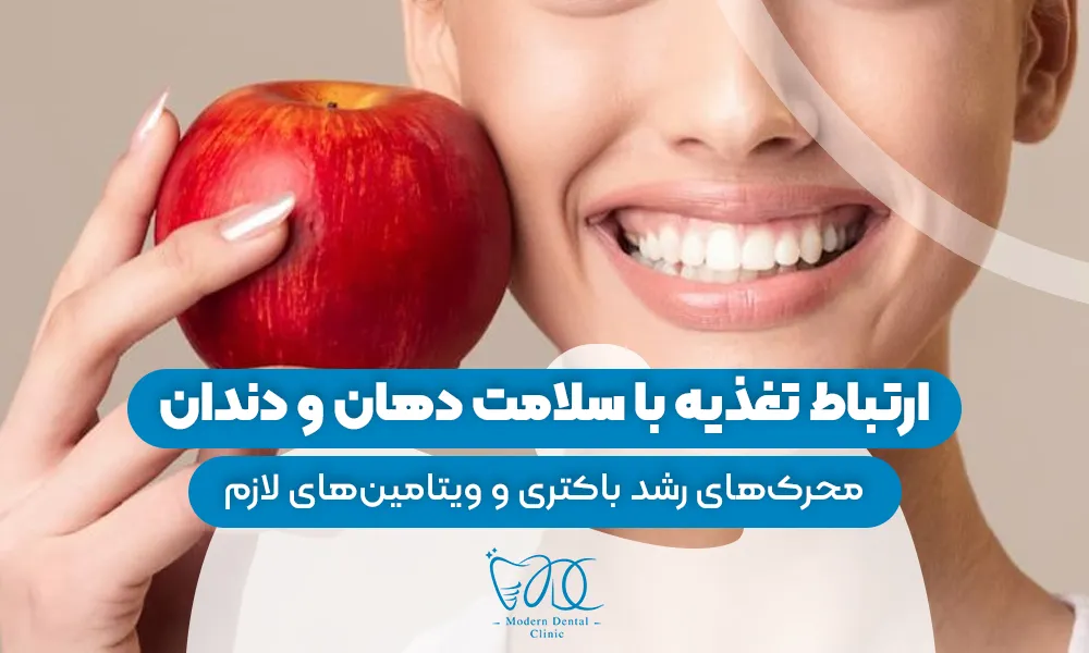 تصویر پیش بار گذاری