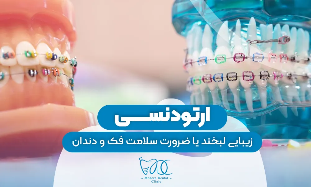 تصویر پیش بار گذاری