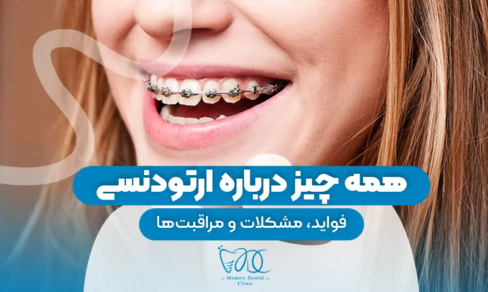 تصویر پیش بار گذاری