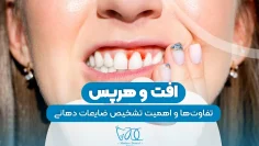 افت و هرپس 1