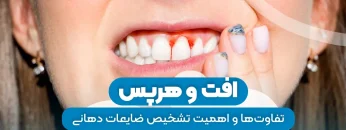 افت و هرپس 1