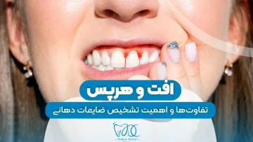 افت و هرپس 1