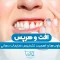 افت و هرپس 1