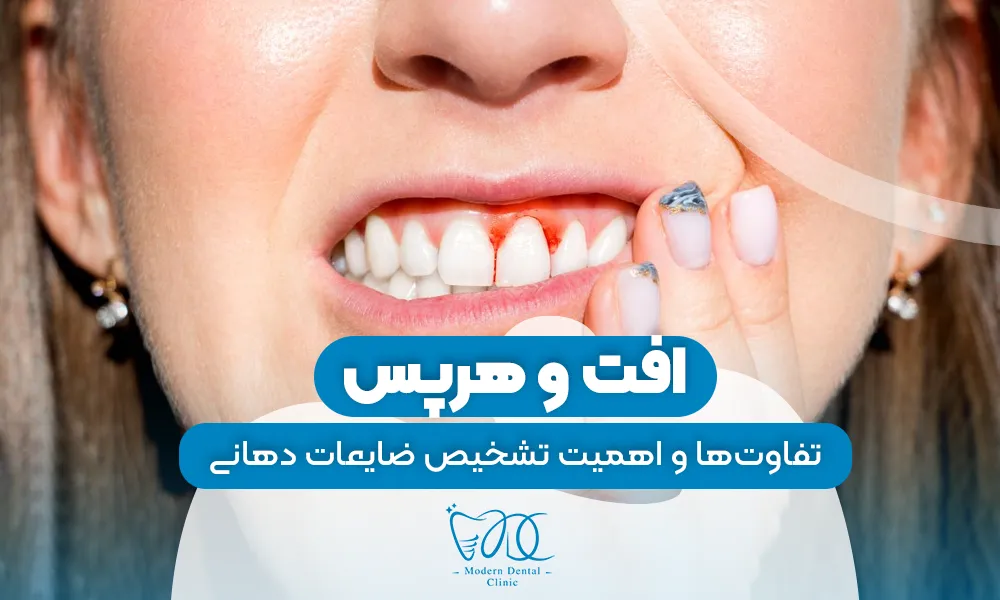 تصویر پیش بار گذاری