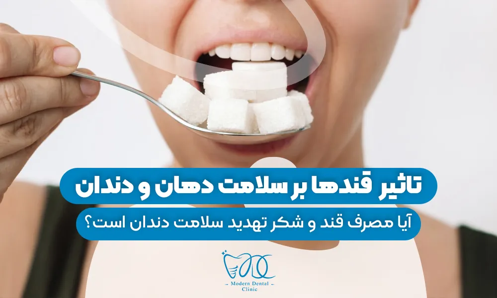 تصویر پیش بار گذاری