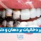 تاثیر دخانیات بر دهان و دندان 1