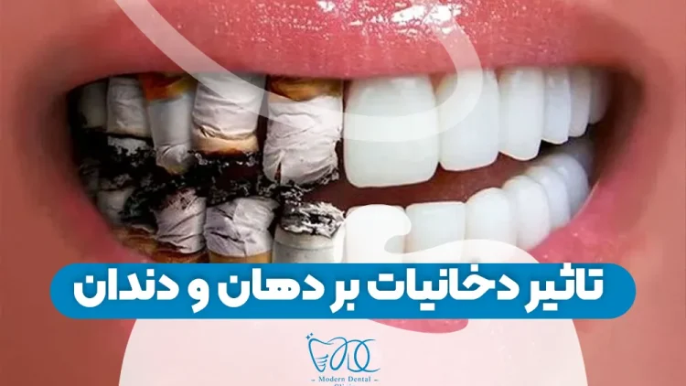 تاثیر دخانیات بر دهان و دندان 1