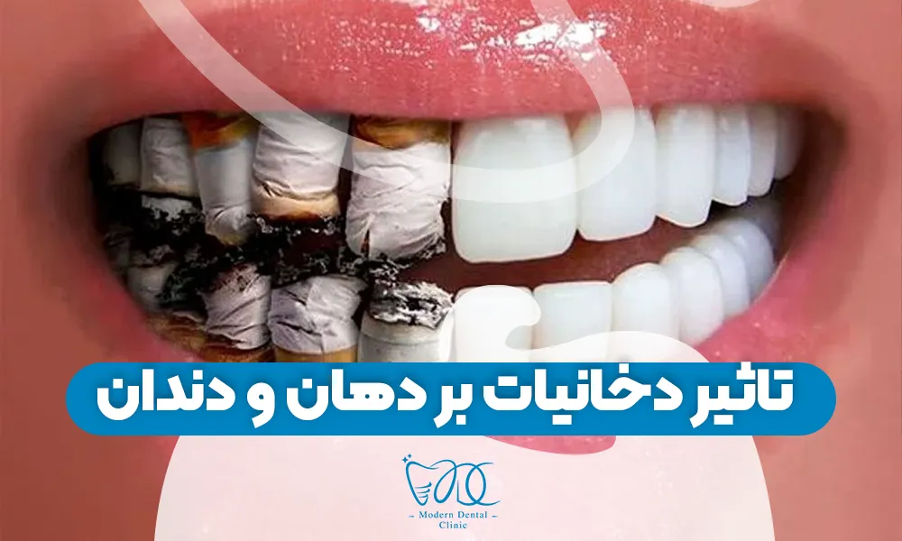 تصویر پیش بار گذاری