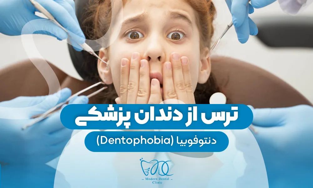 تصویر پیش بار گذاری