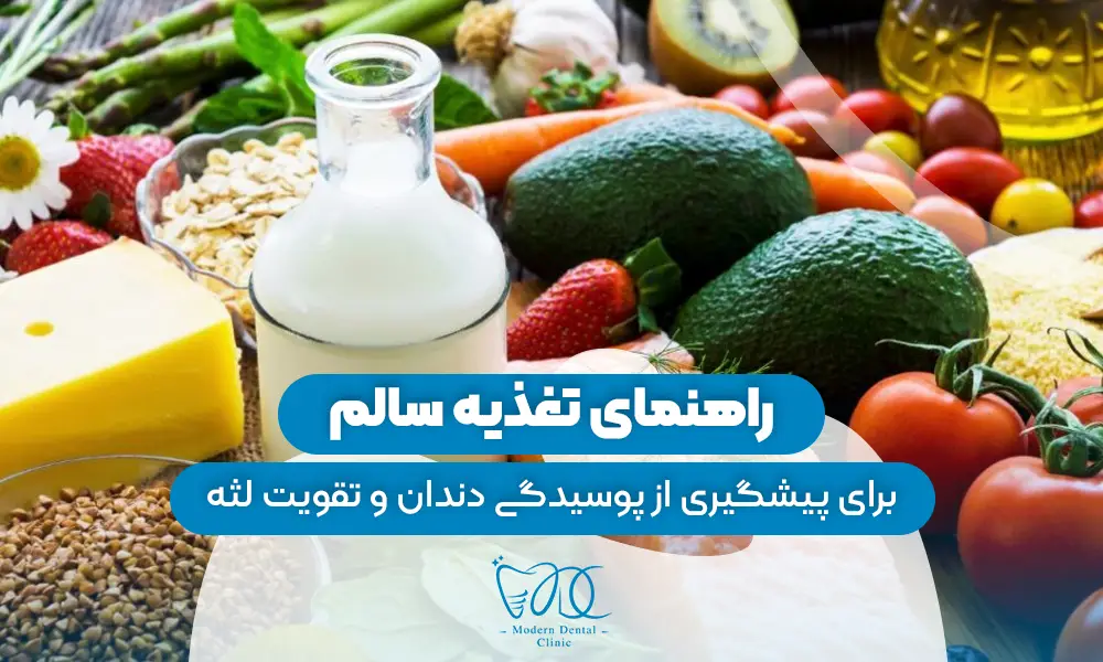تصویر پیش بار گذاری