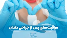 مراقبت‌های پس از جراحی دندان 1