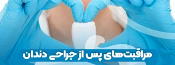 مراقبت‌های پس از جراحی دندان 1