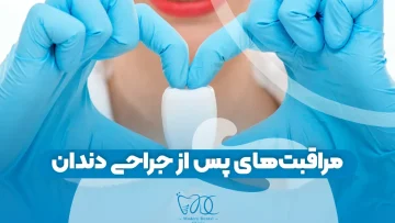 مراقبت‌های پس از جراحی دندان 1
