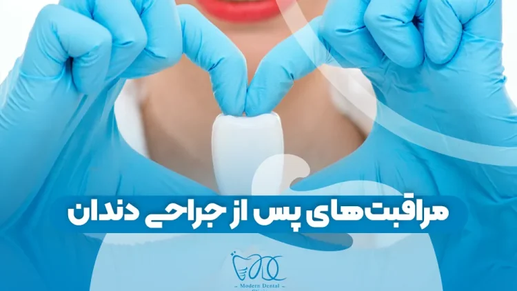 مراقبت‌های پس از جراحی دندان 1