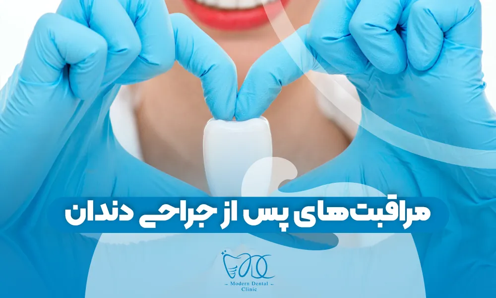 تصویر پیش بار گذاری
