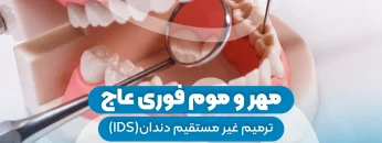 مهر و موم فوری عاج 1