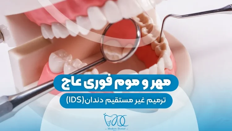 مهر و موم فوری عاج 1