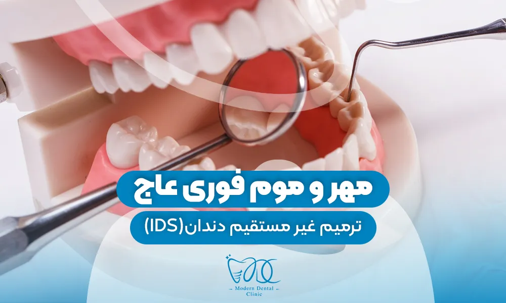 تصویر پیش بار گذاری