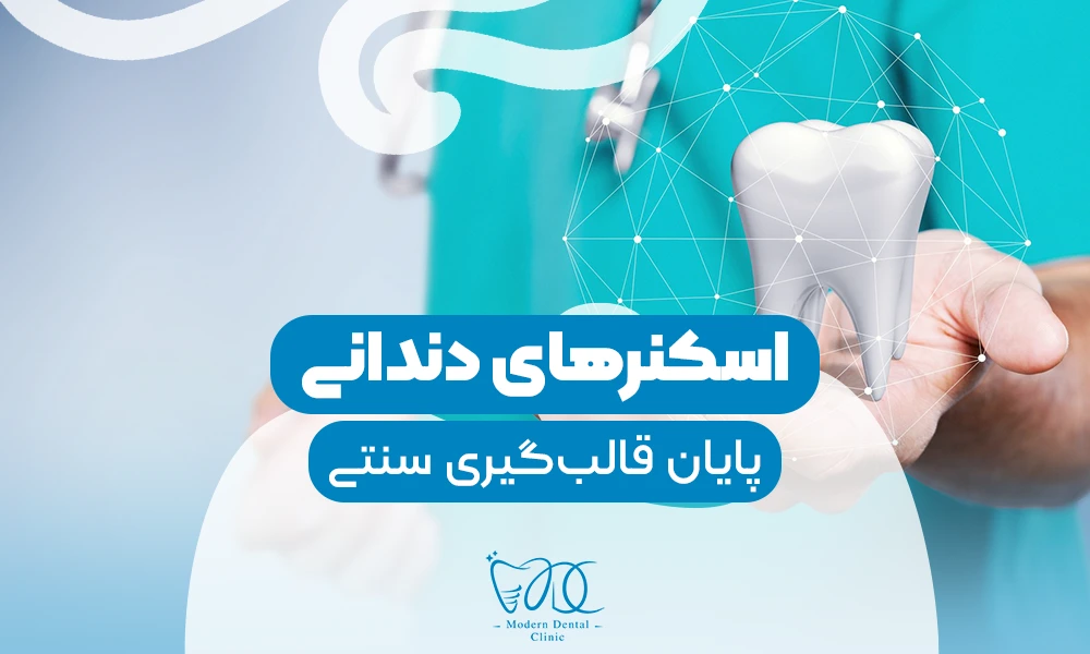 تصویر پیش بار گذاری