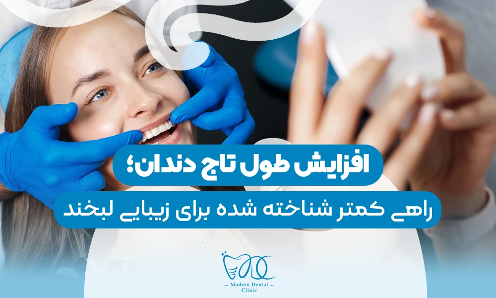 تصویر پیش بار گذاری