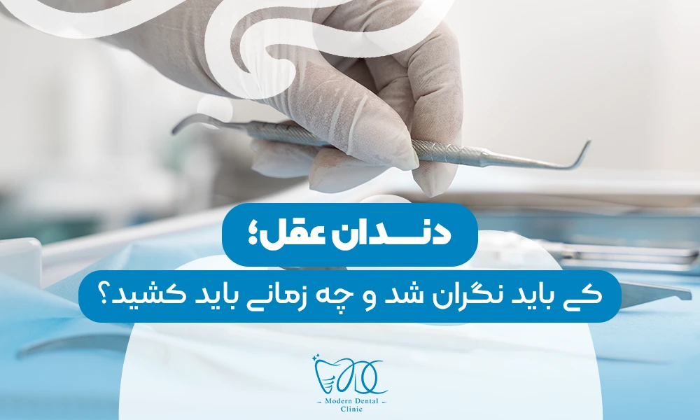 تصویر پیش بار گذاری