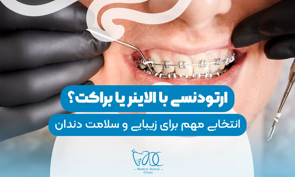 تصویر پیش بار گذاری