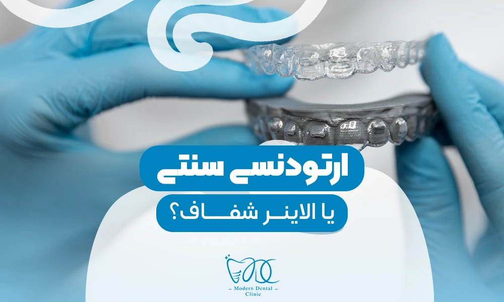 تصویر پیش بار گذاری