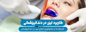 S21- کاربرد لیزر در دندانپزشکی 1