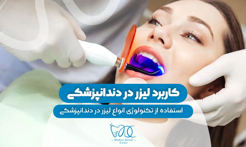 تصویر پیش بار گذاری