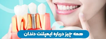 S86- همه چیز درباره ایمپلنت دندان 1
