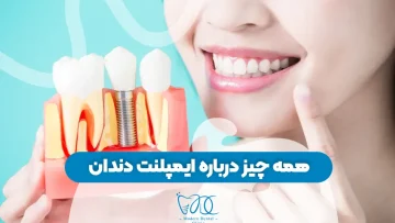 S86- همه چیز درباره ایمپلنت دندان 1