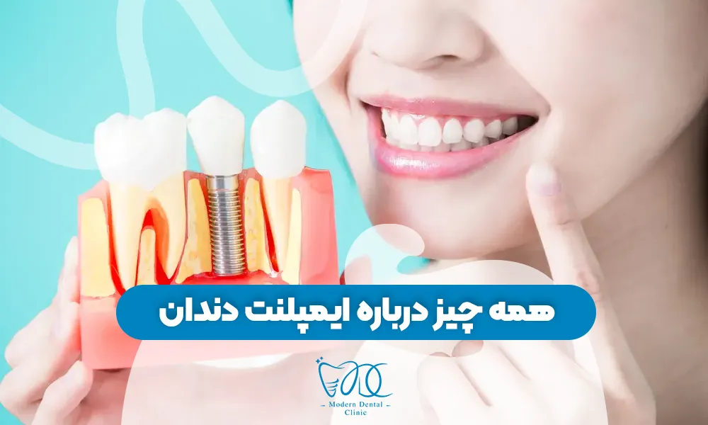 تصویر پیش بار گذاری