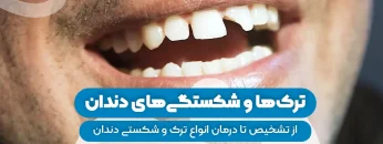 S92-ترک ها و شکستگی های دندان از تشخیص تا درمان 1