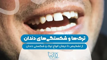 S92-ترک ها و شکستگی های دندان از تشخیص تا درمان 1